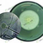 เชื้อรา-Pythium-spp.